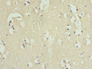 IL9R Antibody