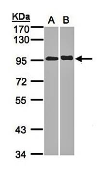 IL2 Receptor beta2 antibody
