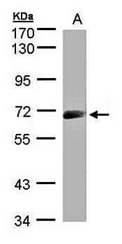IL2Rbeta1 antibody