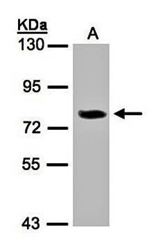 IL7 receptor D antibody
