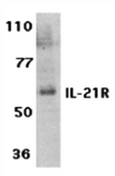 IL-21 Receptor Antibody