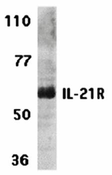 IL-21 Receptor Antibody