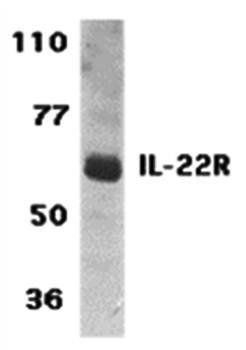 IL-22 Receptor Antibody