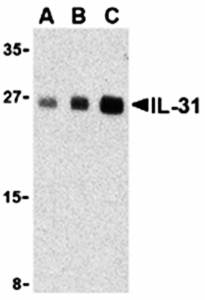 IL-31 Antibody