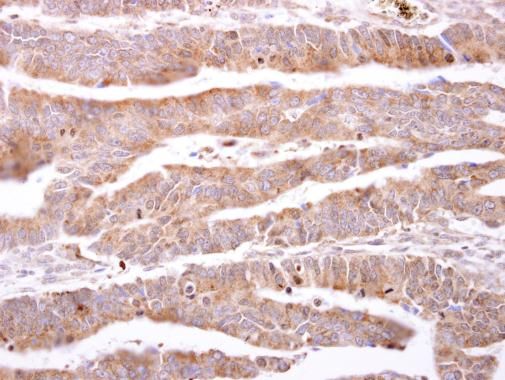 ILBP Rabbit Polyclonal Antibody