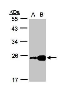 ILBP Rabbit Polyclonal Antibody