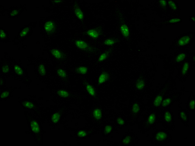 ILF3 Recombinant Monoclonal Antibody