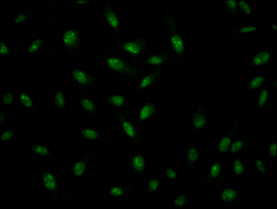 ILF3 antibody