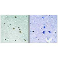ILK (Ab-246) Antibody