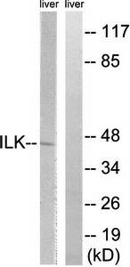 ILK (Ab-246) Antibody