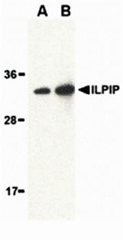 ILPIP Antibody