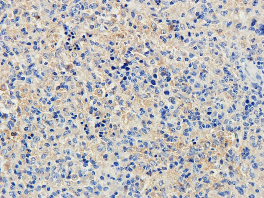 ILT2 Rabbit Polyclonal Antibody