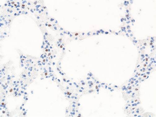 VCAM1 antibody