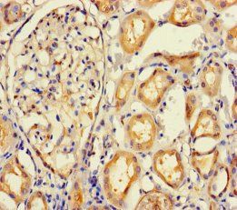 IMPACT Antibody