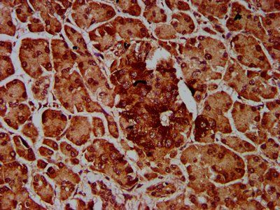 IMPDH1 antibody