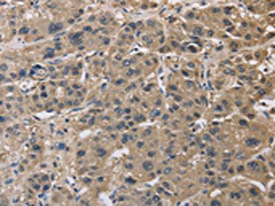 IMPDH1 Antibody