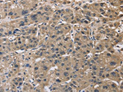 IMPDH1 antibody