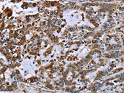 IMPDH2 Antibody