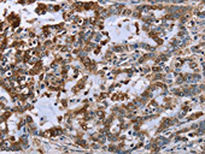 IMPDH2 antibody