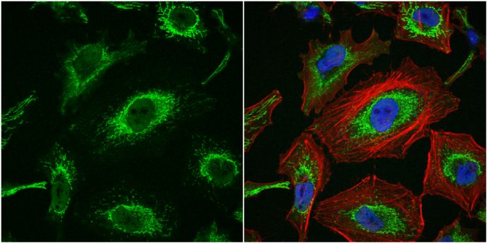 Importin 7 Rabbit Polyclonal Antibody