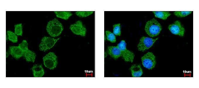 Importin 7 Rabbit Polyclonal Antibody
