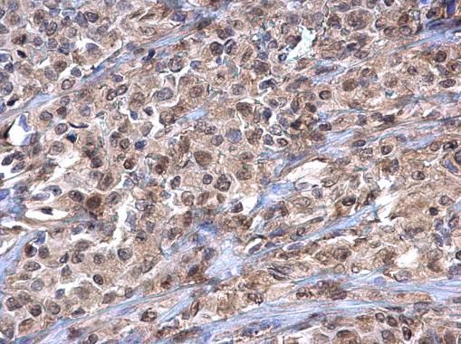 Importin 7 Rabbit Polyclonal Antibody