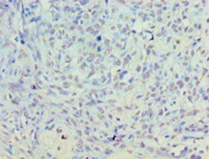 PLD5 Antibody