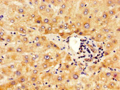 IHH Antibody
