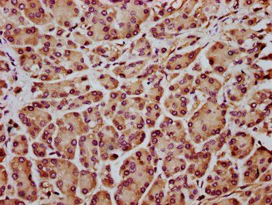 INF2 Antibody