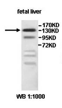 INF2 Rabbit Polyclonal Antibody