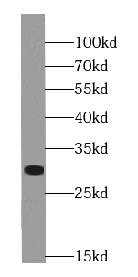 ING1-specific antibody