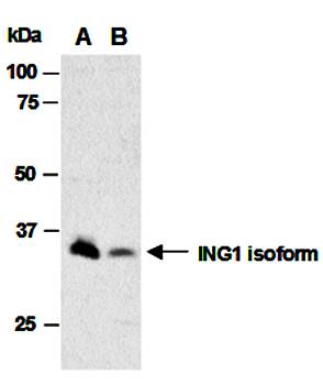 ING1 (M1) Antibody, Rabbit Polyclonal