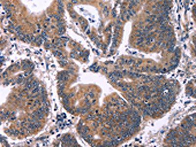 ING2 Antibody