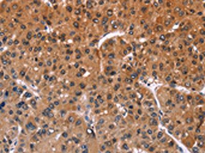 ING2 Antibody