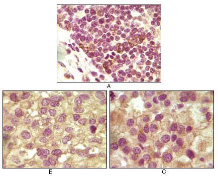 INHA (Inhibin alpha) Antibody