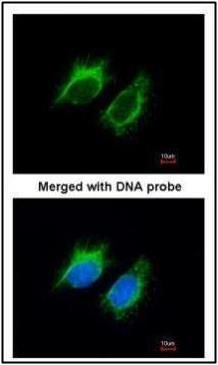 Inhibin beta A Rabbit Polyclonal Antibody