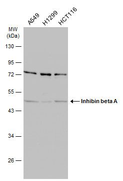 Inhibin beta A Rabbit Polyclonal Antibody