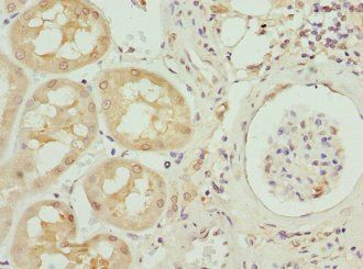 Inhibin beta B chain antibody