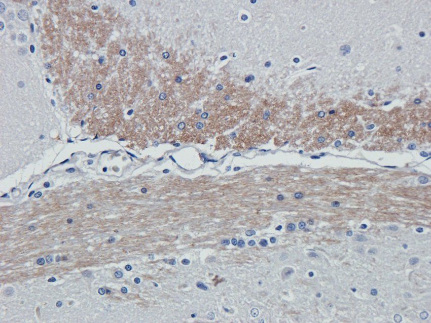 iNOS Rabbit Polyclonal Antibody