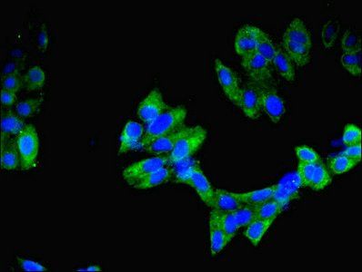 Inosine-5'-monophosphate dehydrogenase 2 antibody