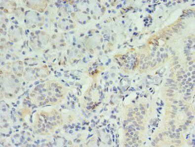 INPP1 antibody