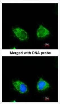 INPP1 antibody [N1C2]