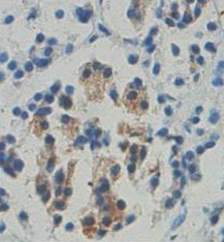 INPP1 Rabbit Polyclonal Antibody