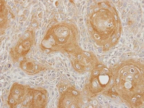 INPP5B Rabbit Polyclonal Antibody