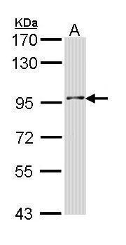 INPP5B Rabbit Polyclonal Antibody