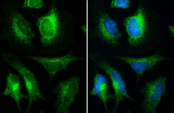 inositol polyphosphate-5-phosphatase F Antibody