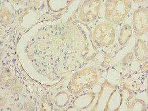 INPP5J Antibody