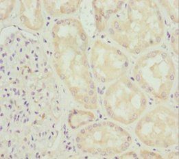 INPP5K Antibody