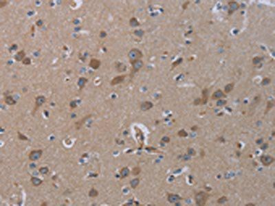 INSIG2 Antibody