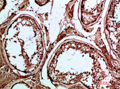 INSL3 Antibody